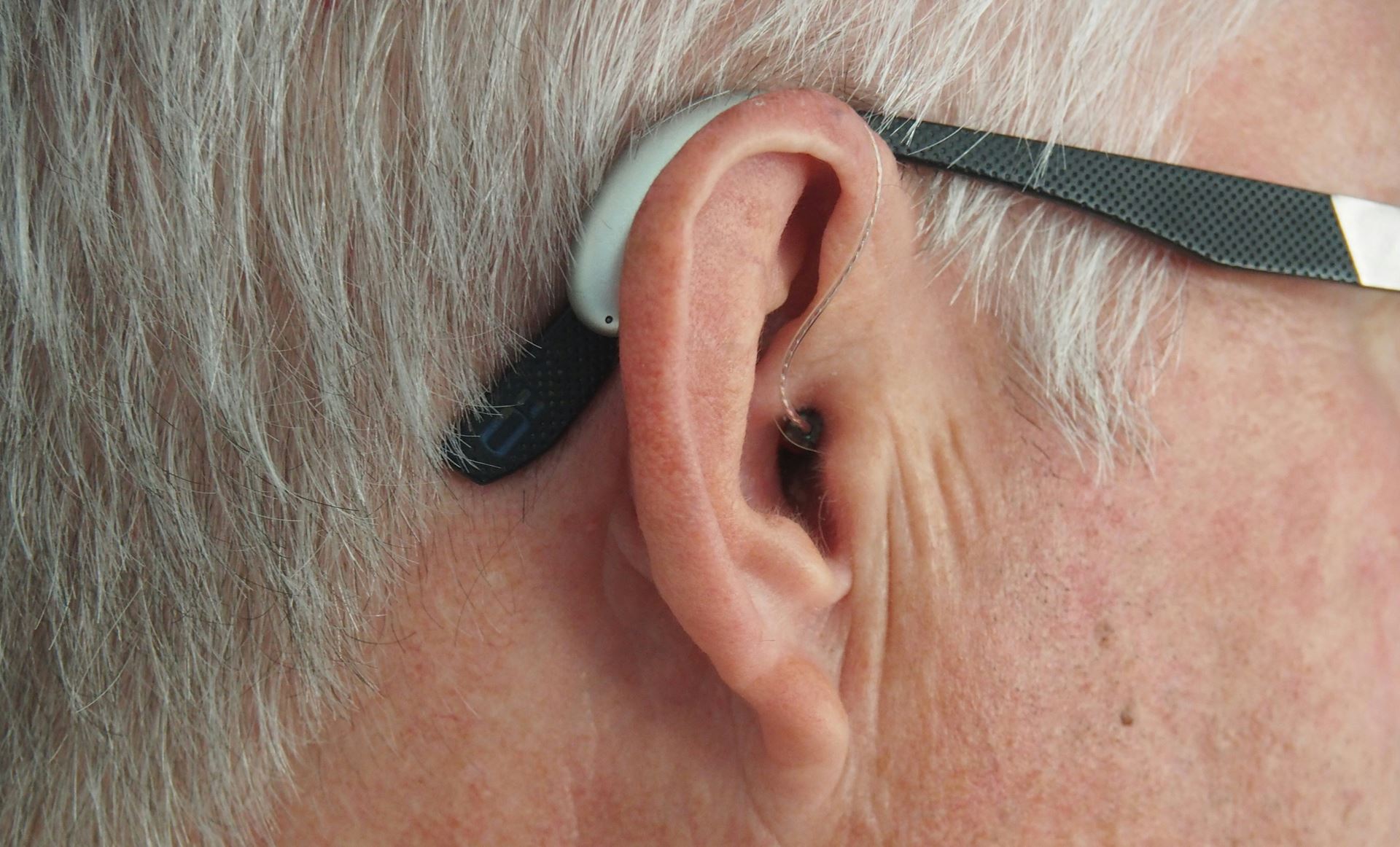 Photo of ear